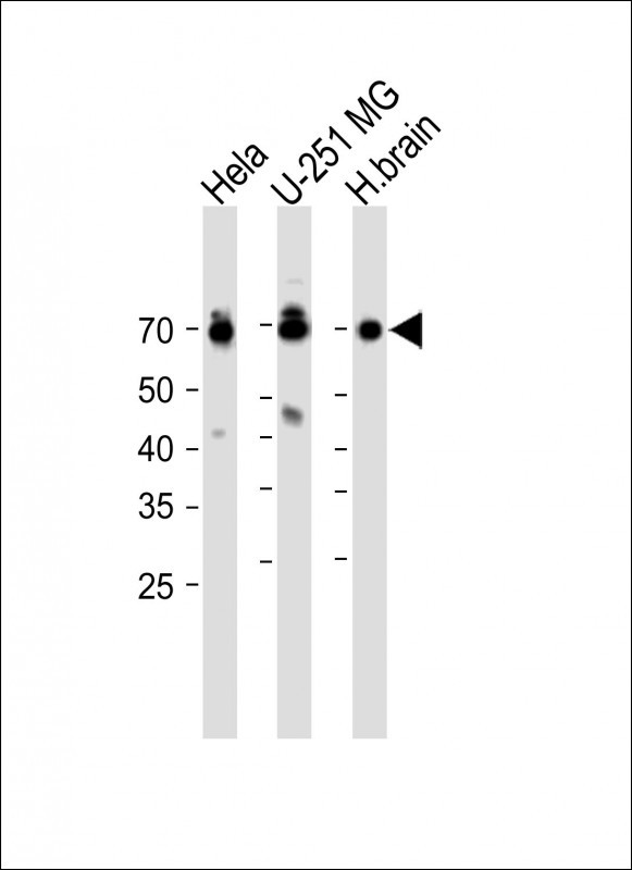 TMEM106B