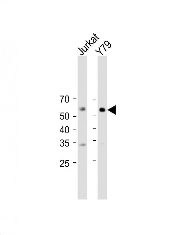 WDR51B
