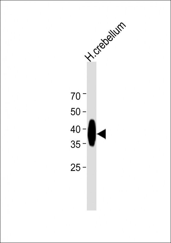 PQLC2