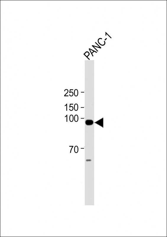 PPEF2
