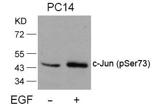 c-Jun(Phospho-Ser73)