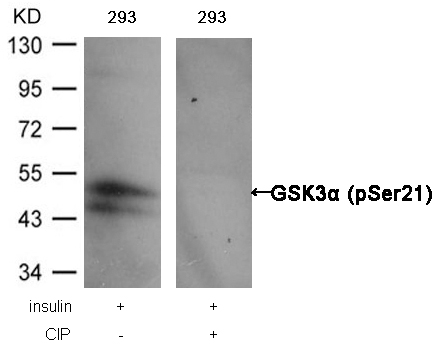 Rabbit Polyclonal Antibody to GSK3a(Phospho-Ser21)