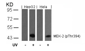 MEK2(Phospho-Thr394)