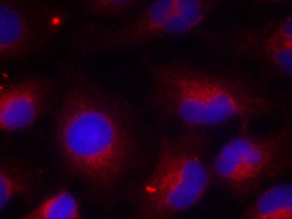 PTEN(Phospho-Ser380)