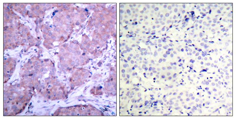 Rabbit Polyclonal Antibody to PTEN(Phospho-Ser380)