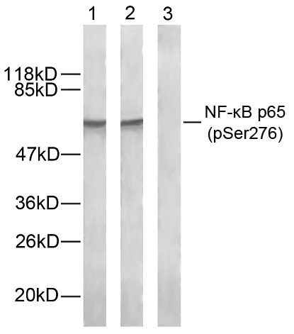 NFkB-p65(Phospho-Ser276)