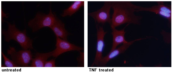 Rabbit Polyclonal Antibody to NFkB-p65(Phospho-Ser276)
