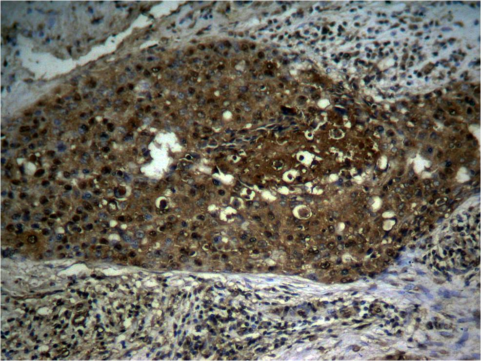 Rabbit Polyclonal Antibody to NFkB-p65(Phospho-Ser276)