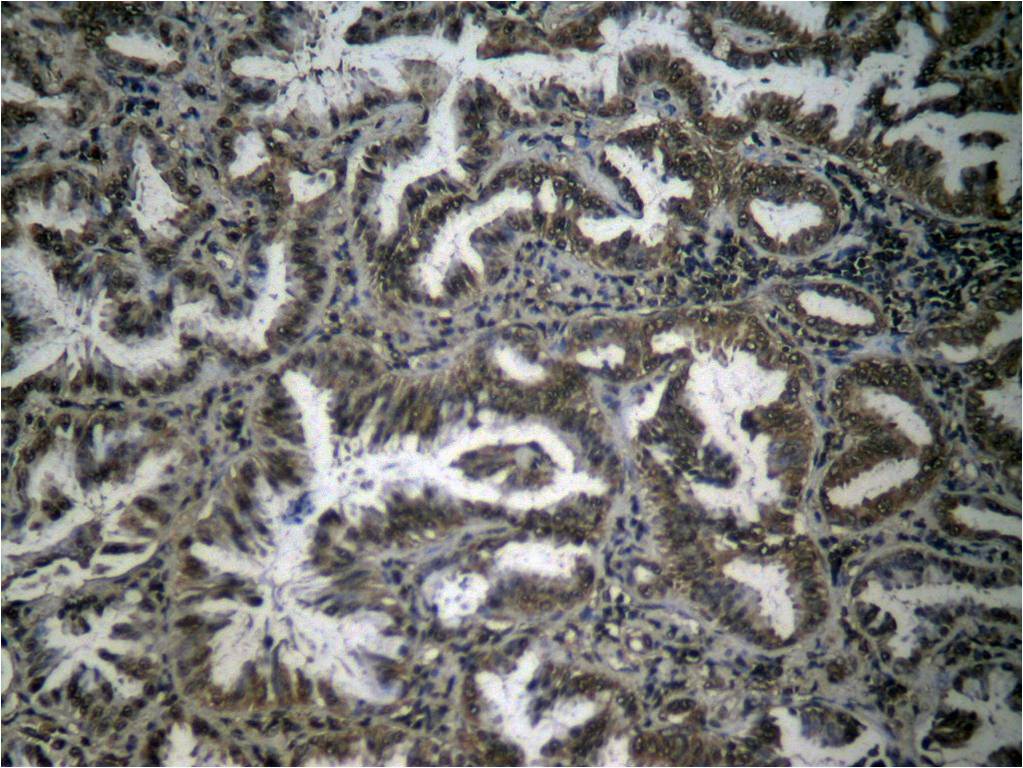 Rabbit Polyclonal Antibody to NFkB-p65(Phospho-Ser276)