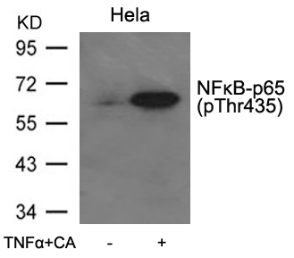NFkB-p65(Phospho-Thr435)