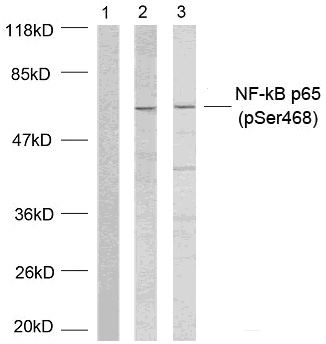 NFkB-p65(Phospho-Ser468)