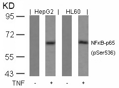 NFkB-p65(Phospho-Ser536)