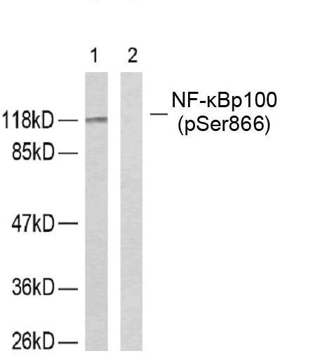 NFkB-p100(Phospho-Ser866)