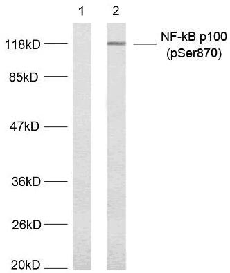 NFkB-p100(Phospho-Ser870)