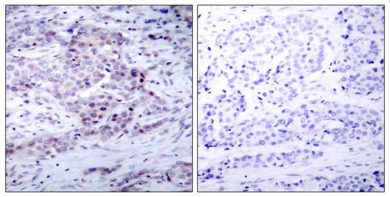 Rabbit Polyclonal Antibody to NFkB-p100(Phospho-Ser870)