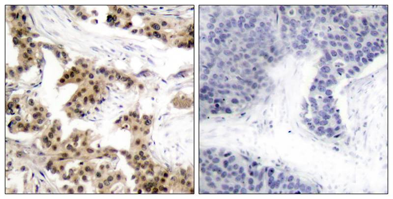 Rabbit Polyclonal Antibody to NFkB-p105(Phospho-Ser893)