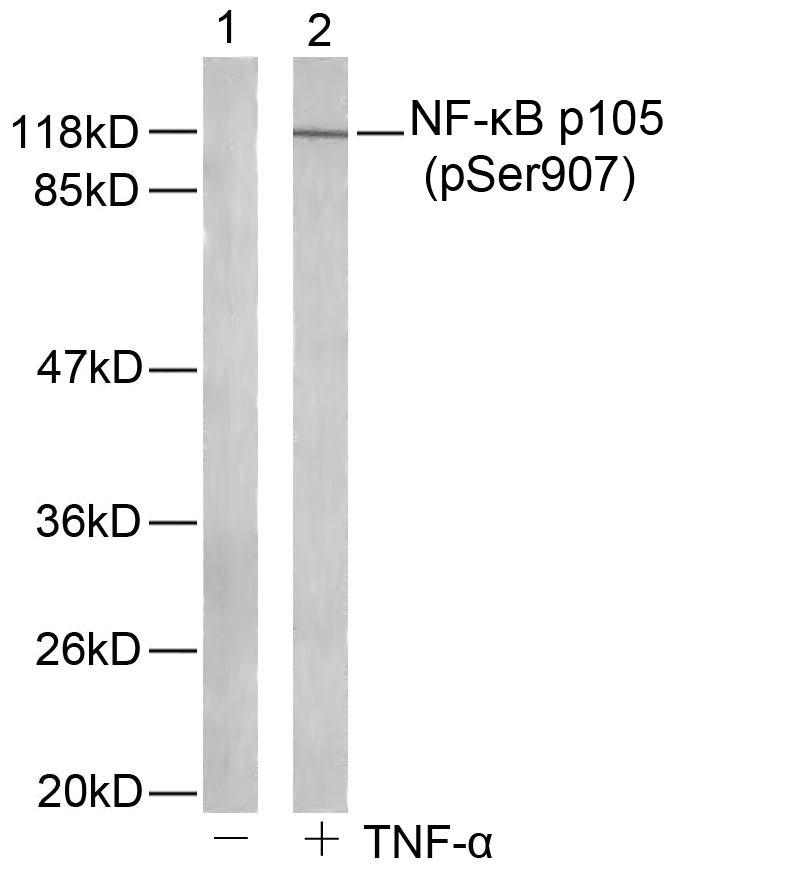 NFkB-p105(Phospho-Ser907)