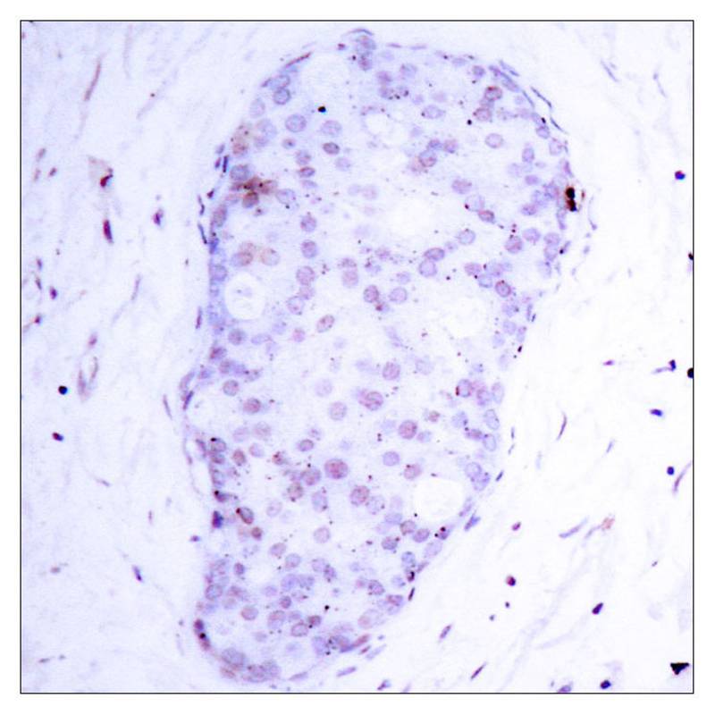 Rabbit Polyclonal Antibody to NFkB-p105(Phospho-Ser907)