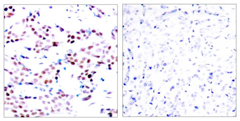 Rabbit Polyclonal Antibody to c-Jun(Phospho-Thr91)