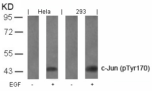 c-Jun(Phospho-Tyr170)