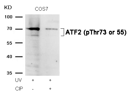 Rabbit Polyclonal Antibody to ATF2(Phospho-Thr73 or 55)