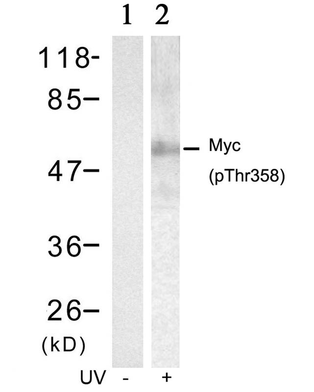 Myc(Phospho-Thr358)