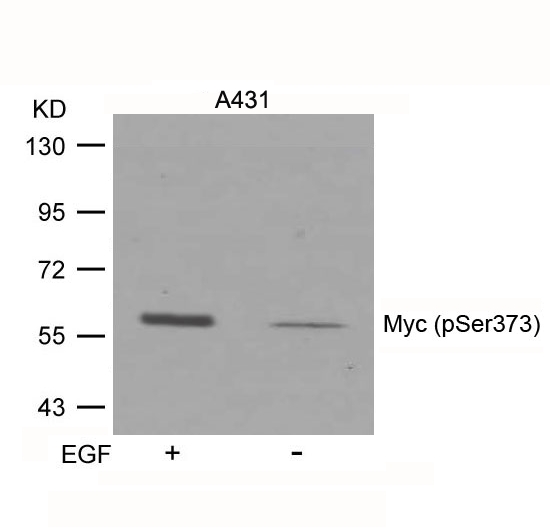 Myc(Phospho-Ser373)