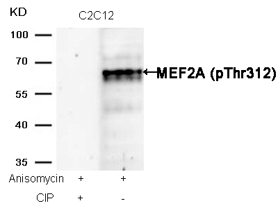 MEF2a(Phospho-Thr312)