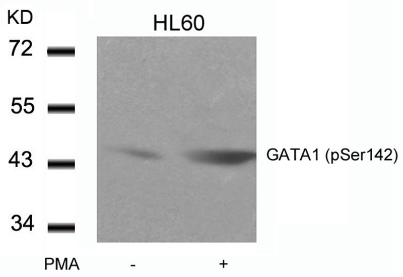 GATA1(Phospho-Ser142)