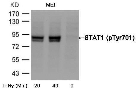 STAT1(Phospho-Tyr701)
