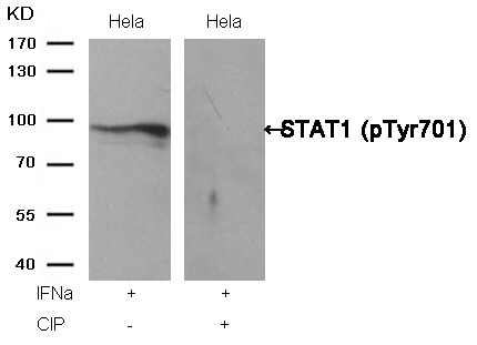 Rabbit Polyclonal Antibody to STAT1(Phospho-Tyr701)