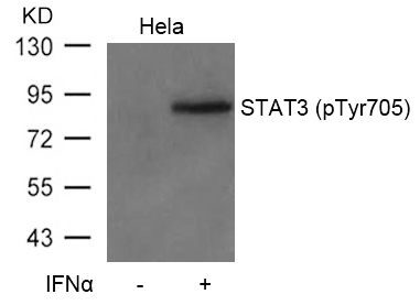 STAT3(Phospho-Tyr705)