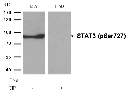 Rabbit Polyclonal Antibody to STAT3(Phospho-Ser727)