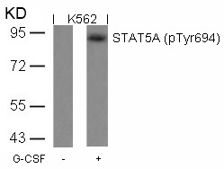 STAT5a(Phospho-Tyr694)