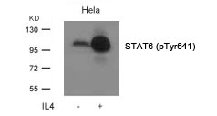 STAT6(Phospho-Tyr641)