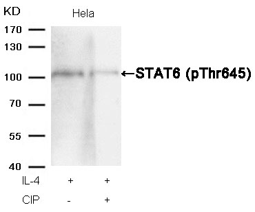 STAT6(Phospho-Thr645)
