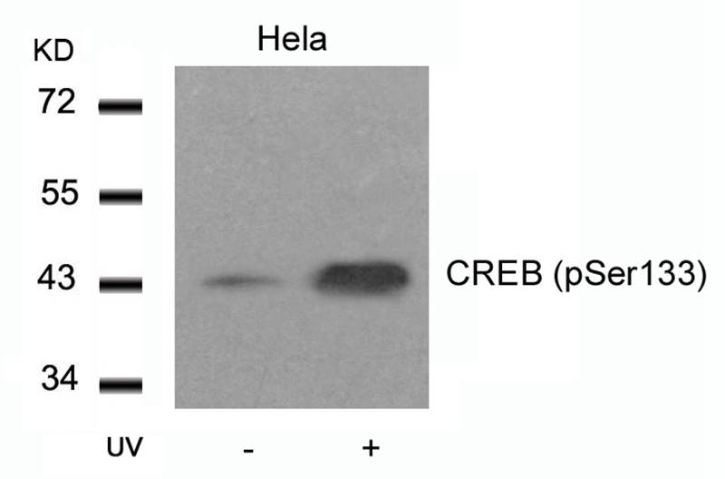 CREB(Phospho-Ser133)