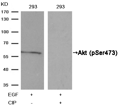 Akt(Phospho-Ser473)