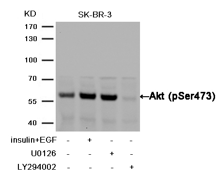 Rabbit Polyclonal Antibody to Akt(Phospho-Ser473)