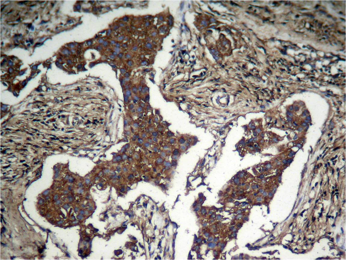 Rabbit Polyclonal Antibody to Akt(Phospho-Ser473)