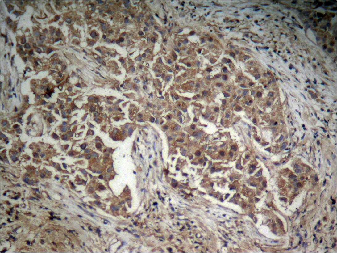 Rabbit Polyclonal Antibody to Akt(Phospho-Thr308)