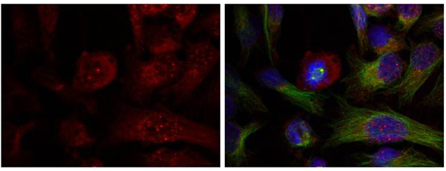 Rabbit Polyclonal Antibody to Akt(Phospho-Thr308)