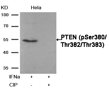 Rabbit Polyclonal Antibody to PTEN(Phospho-Ser380/Thr382/Thr383)