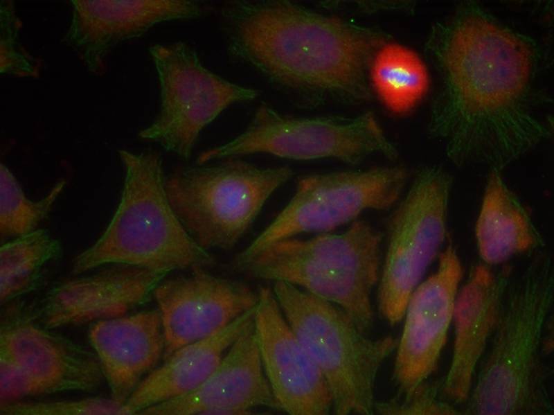 Rabbit Polyclonal Antibody to PTEN(Phospho-Ser380/Thr382/Thr383)
