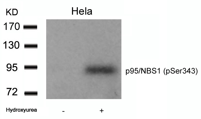 p95/NBS1(Phospho-Ser343)