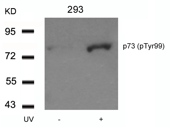 p73(Phospho-Tyr99)