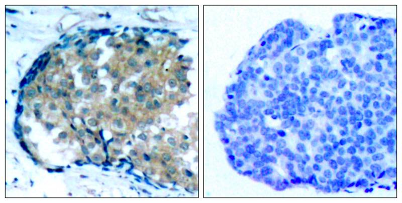 Rabbit Polyclonal Antibody to Ezrin(Phospho-Tyr353)