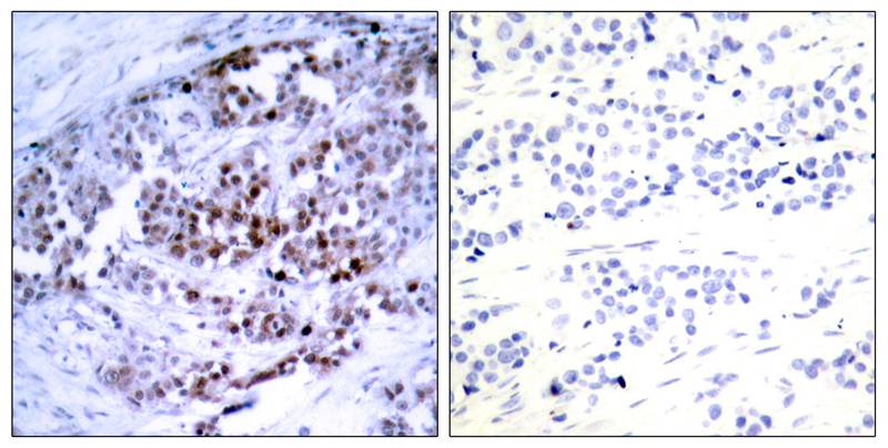 BCL-2(Phospho-Ser70)