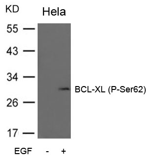 Rabbit Polyclonal Antibody to BCL-XL(Phospho-Ser62)