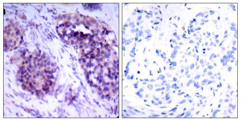 Rabbit Polyclonal Antibody to BCL-XL(Phospho-Ser62)